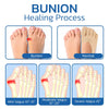 Projoint AntiBunions Health Sock